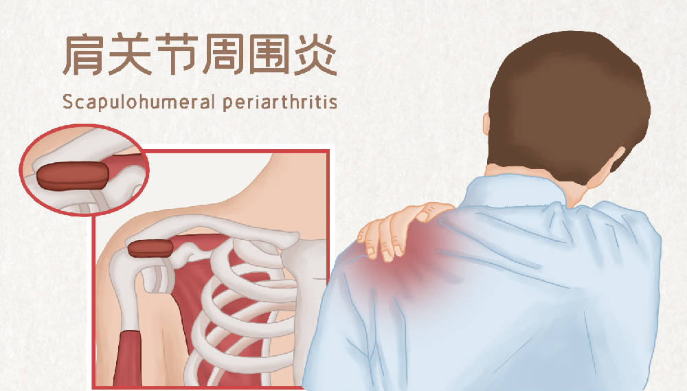 邵陽(yáng)創(chuàng)傷骨科,邵陽(yáng)風(fēng)濕病區(qū),邵陽(yáng)骨質(zhì)增生,邵陽(yáng)關(guān)節(jié)病區(qū),邵陽(yáng)頸椎病區(qū)