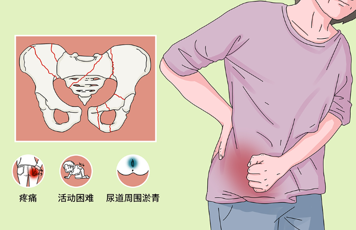 邵陽創(chuàng)傷骨科,邵陽風濕病區(qū),邵陽骨質(zhì)增生,邵陽關(guān)節(jié)病區(qū),邵陽頸椎病區(qū)